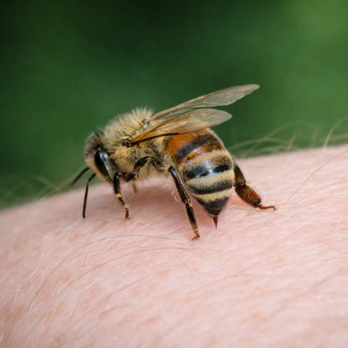 What Is A Bee Sting?