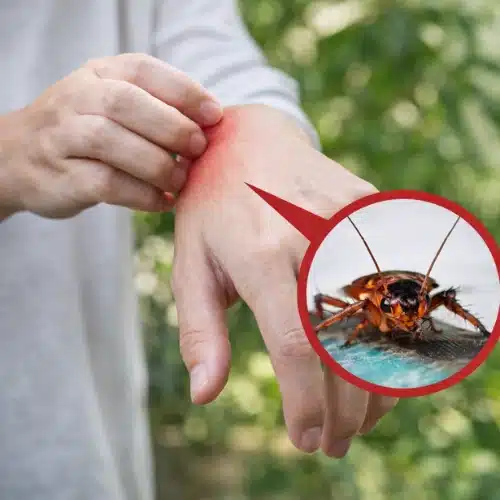 What Do Cockroach Bites Look Like?