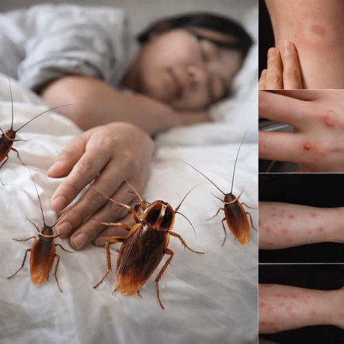 Do Cockroaches Bite Humans