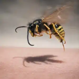 Wasp Stings